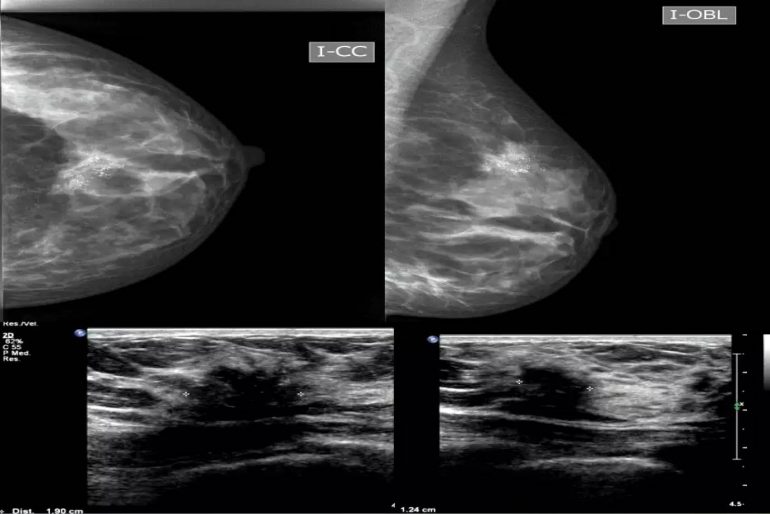 DIAGNOSTICO DIFERENCIAL EMBARAZO diagnostico diferencial embarazo: