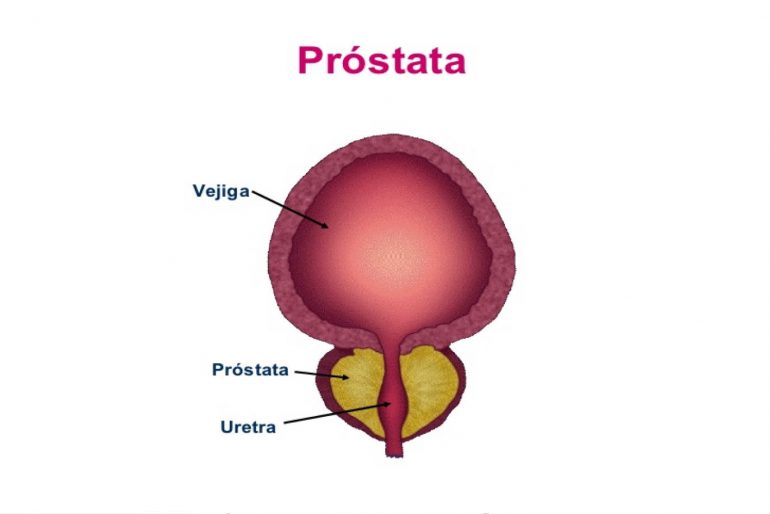 volumen y edad de la glándula prostática