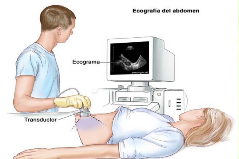 Resultado de imagen para ultrasonografia