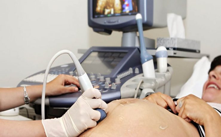 La pérdida de un embarazo a cualquier edad gestacional, representa un evento significativo, y más el momento devastador para quien el experimento. Aborto Espontánea es una de las complicaciones obstétricas más comunes en la población en edad de concebir. Afecta a alrededor del 15%de todos los embarazos clínicamente identificados, y la importancia clínica de este indiscutible problemática.1, 2.3 La etiología de la pérdida del embarazo, lo que no siempre es posible para determinar, en algunos casos, es multifactorial. Sin embargo, es innegable que las alteraciones genéticas desempeñan un papel este fundamental complicado.2, 4