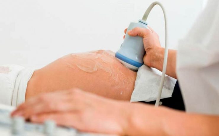 La placenta madura es una azul-roja, redondeada e importante órgano de 15-20 cm de diámetro y 3 cm de espesor. Con un peso de 400-600 g o aproximadamente una sexta parte del peso del recién nacido a término. El cordón umbilical (funis) se extiende desde la cara fetal del ombligo del feto. Las membranas fetales cubren la cara fetal y se extiende desde el margen placentario hasta el espacio ocupado por el feto, líquido amniótico y cordón umbilical.
