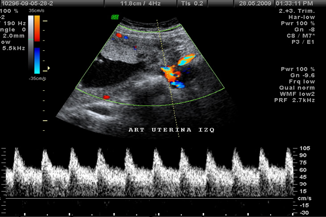 anatomía de la arteria uterina